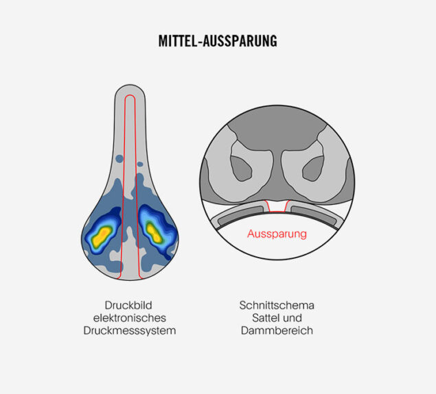 Intelligente Aussparung-Der Dammbereich wird deutlich entlastet